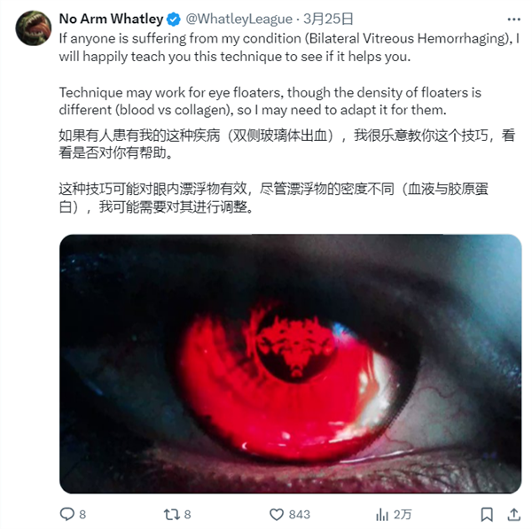 永不言弃！《英雄联盟》主播因意外几乎全盲：靠自创“真实技能”重回大师(图4)